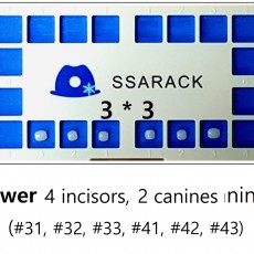 Ssarack Lower 3*3 Set (6ea)