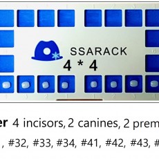 Ssarack Lower 4*4 Set (8ea)